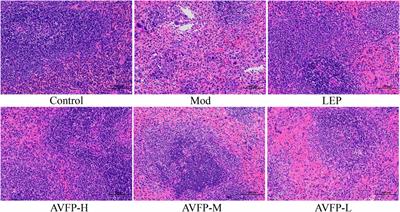 Prevention of cyclophosphamide-induced immune suppression by polysaccharides from Apocynum venetum flowers via enhancing immune response, reducing oxidative stress, and regulating gut microbiota in mice